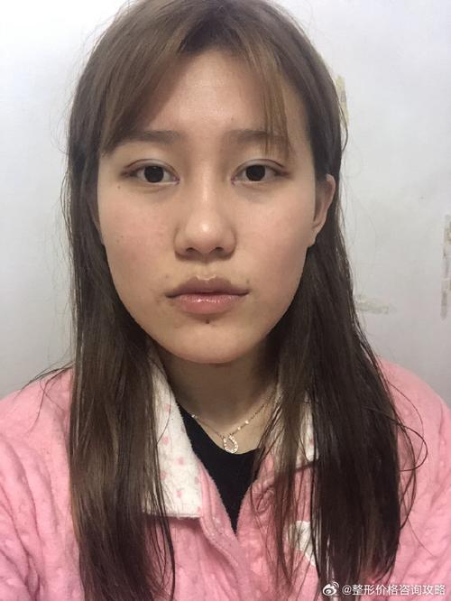 视角:给照片换双不一样的眼睛